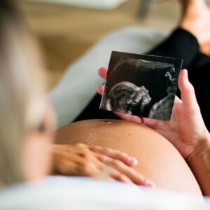 a pregnant woman looking at an ultrasound